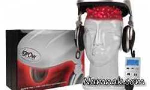 درمان طاسی سر